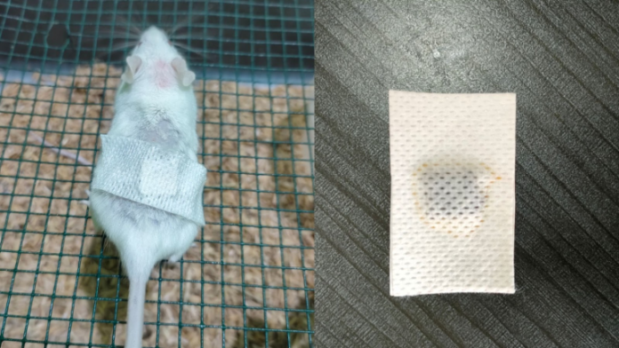 Hydrogel Patch, Innovation of PKM-RE Team Pined Patch Helps Overcome Diabetic Ulcer Disorders on the Feet